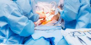 Nefrectomía Radical